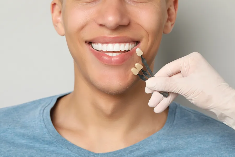Porcelain tooth shells held beside a patient’s smile